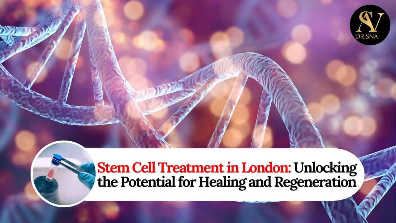 Stem Cell Treatment in London: Unlocking the Potential for Healing and Regeneration - Dr. SNA Clinic